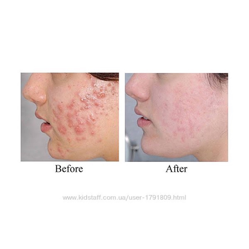 Tinh chất iS Clinical Mini (Hydra Cool - Pro Heal - Super Serum 3,75ml