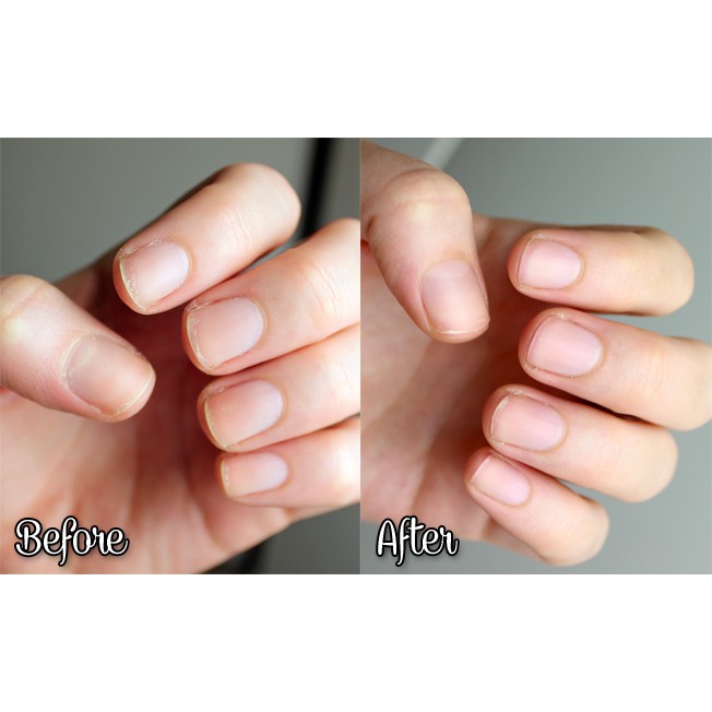 (BILL US) KẸO DẺO MỌC TÓC, MÓNG, ĐẸP DA HAIR SKIN NAILS GUMMIES 80 viên
