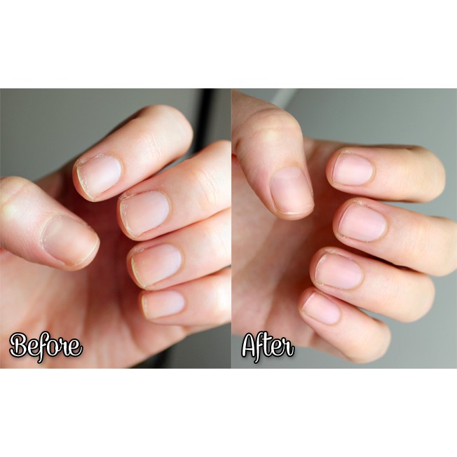 Hair Skin and Nails- đẹp da, tóc và móng