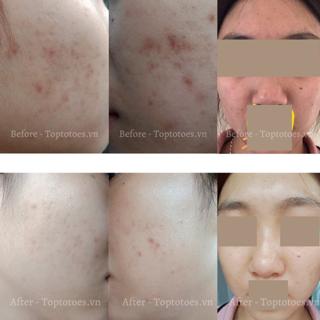 Serum Teana Super Peptides ASAP dưỡng trắng, mờ thâm, cải thiện kết cấu da | BigBuy360 - bigbuy360.vn