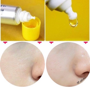 serum vitamin C #Melano CC Rohto