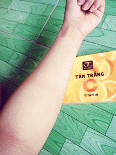 Tắm trắng vitamin C