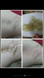 [Freeship 99k]_Combo 5 bộtriệt lông gồm wax shiny và mỡ trăn 50ml( có tặng kèm giấy và que wax)