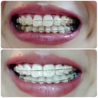 Kem đánh răng trắng sáng Mỹ Ap24
