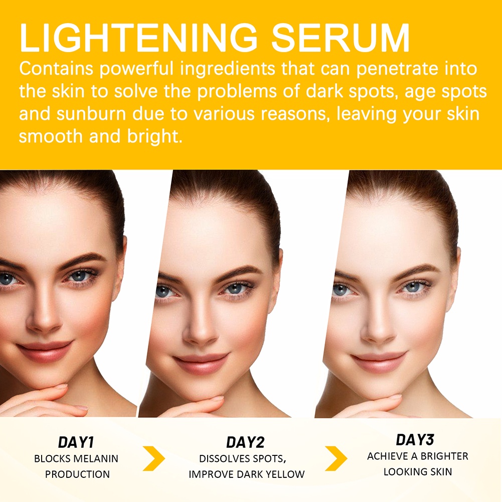 Vitamin C Phai Tại Chỗ Huyết Thanh Giữ Ẩm Tại Chỗ Loại Bỏ Mụn Trứng Cá Sáng Da Toneserum