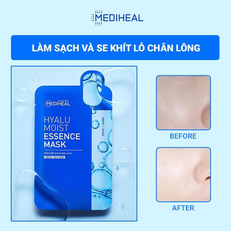 (MẪU MỚI) Mặt Nạ Dưỡng Da Mediheal Essential Mask EX  2021 sẵn hàng