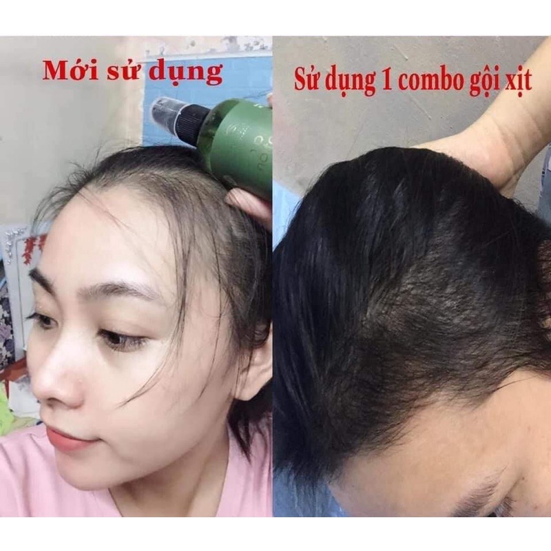 Xịt dưỡng tóc hair lotion, Tinh dầu bưởi Vijully, Ngăn Ngừa Rụng Tóc, Kích Thích Mọc Tóc, 100ml