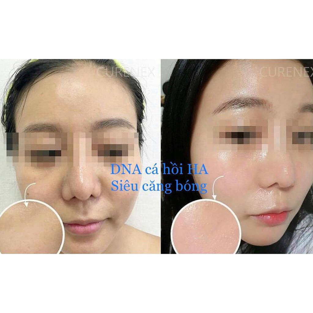 Tinh chất tế bào gốc cá hồi Salmon DNA HA Super Skin