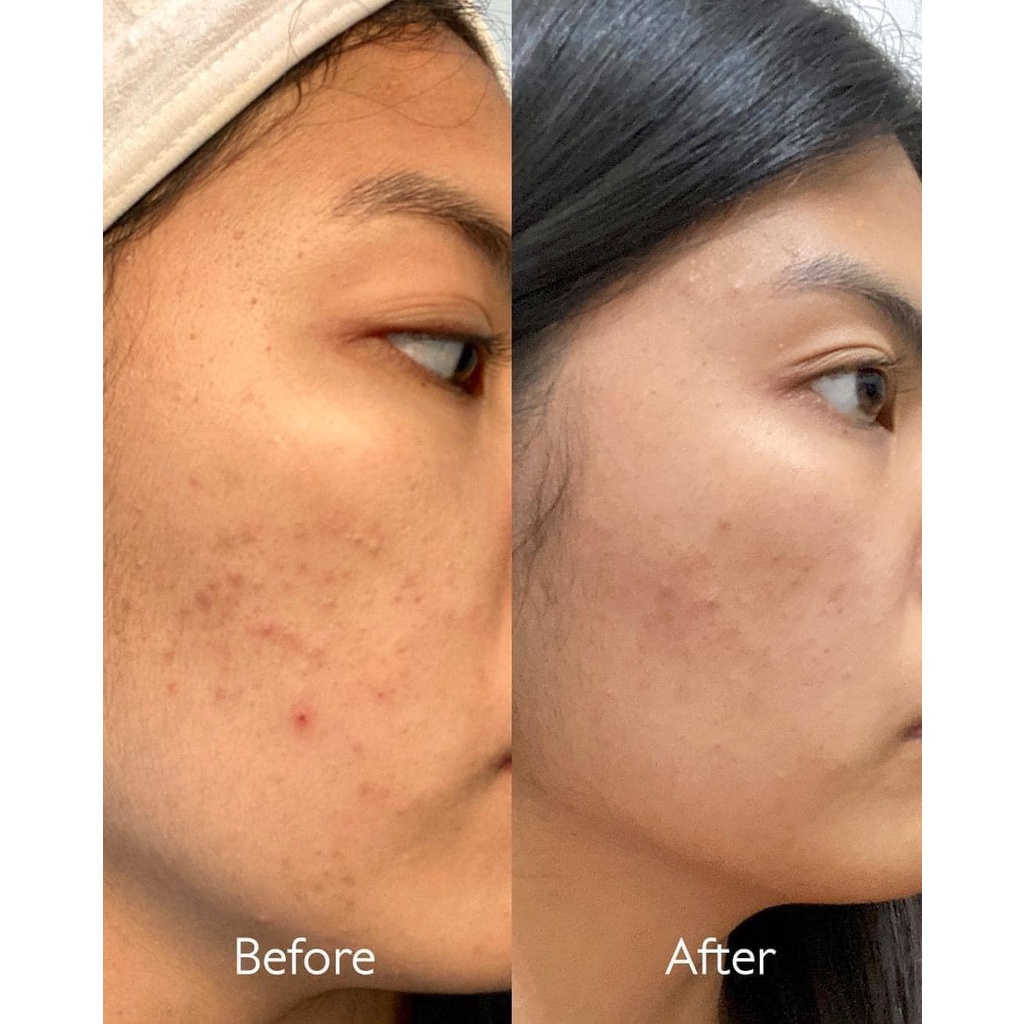 Serum Caudalie Vinoperfect Radiance Serum Complexion Correcting trắng sáng da, giảm thâm nám mẫu mới F