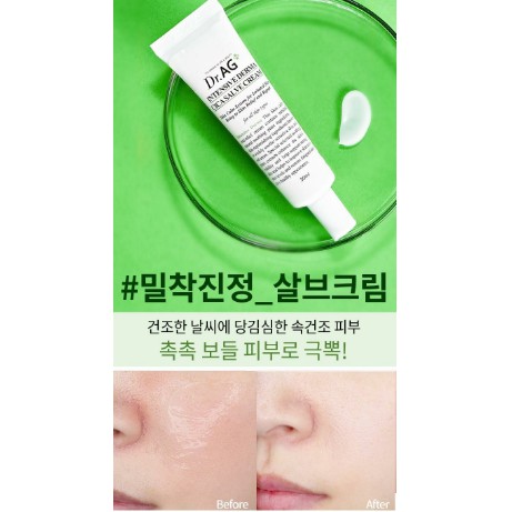 KEM DƯỠNG CHO DA MỤN, DA NHẠY CẢM Dr.Ag Intensive Derma Cica Salve Cream