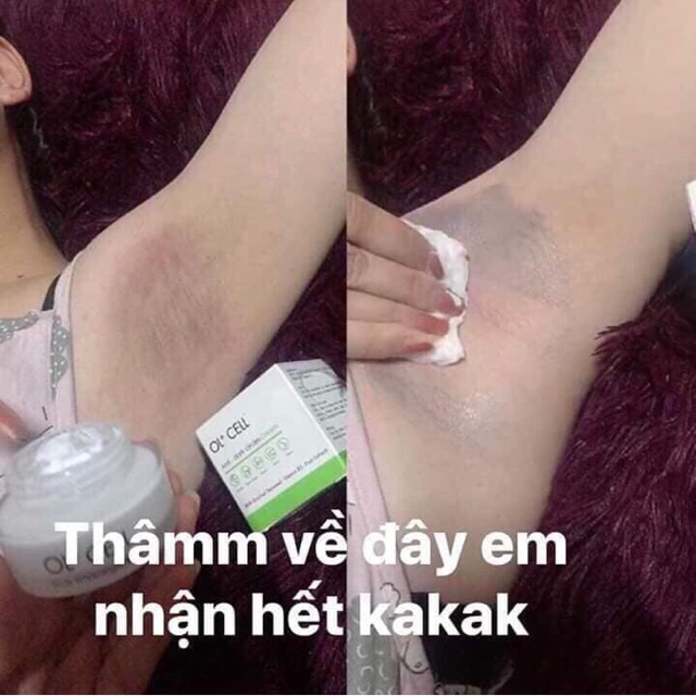 KEM HÚT THÂM NÁCH,NHŨ HOA,BẸN,MÔNG,ĐẦU GỐI...OL+CELL - TMZ SHOP - Thymozin 305 | BigBuy360 - bigbuy360.vn