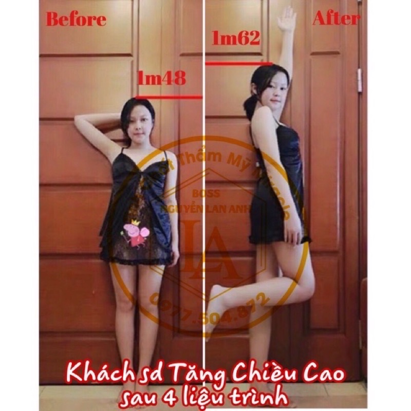 Tinh chất tăng chiều cao Miracle, hiệu quả chỉ sau 1 tháng