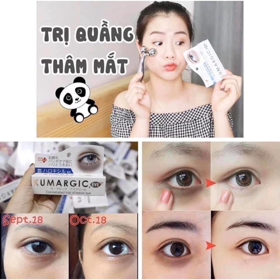 Kem Giảm Thâm Quầng Mắt Nhật Cream Kumargic Concetrated Trial Of Below Eye 20g