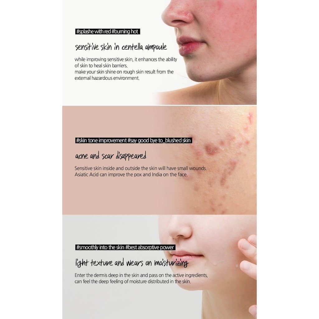 Centella Skin 1004 100ml - Skin 1004 Madagascar Centella Ampoule-  Serum Rau Má Centella | BigBuy360 - bigbuy360.vn