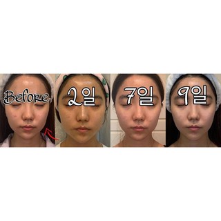 Dr. nds - bộ sản phẩm làm sáng nâng cơ - chống lão hoá