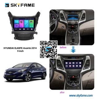 Mặt dưỡng huyndai elantra 2014-2015+jak cắm zin
