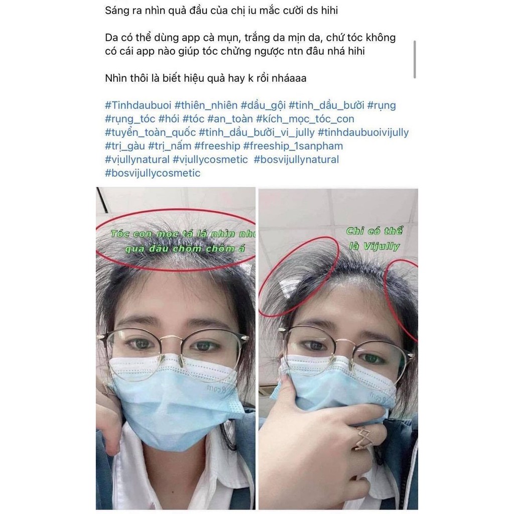 Tinh dầu bưởi Vi Jully Kích Thích Mọc Tóc Và Giảm Rụng Tóc | BigBuy360 - bigbuy360.vn