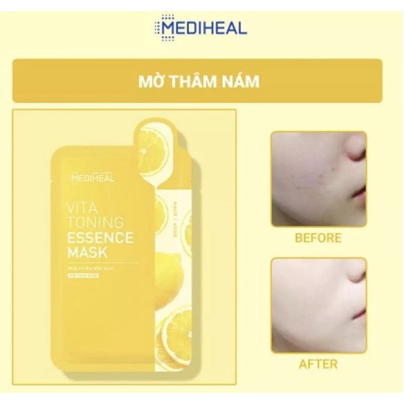 Mặt Nạ Giấy Mediheal Mask 20ML Mẫu Mới 2021