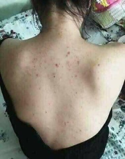 TẮM TRẮNG BỘT THẢO DƯỢC QUYÊN LARA