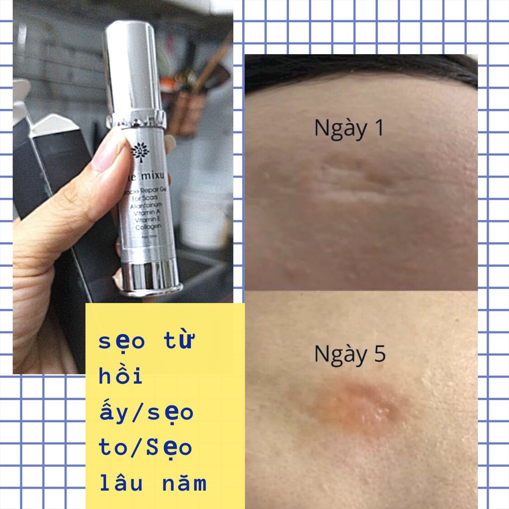 Gel liền sẹo rỗ,sẹo lồi. sẹo lâu năm, lỗ chân lông to ngừa thâm mụn.Mixu.haloha.hanmade