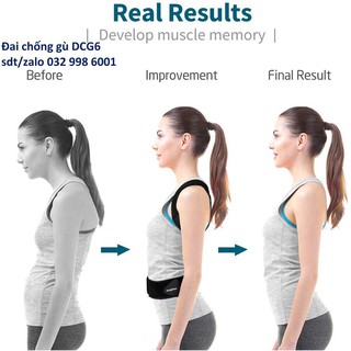 [Đủ size] Đai chống gù lưng cho người lớn, trẻ nhỏ [Được đeo thử hài lòng mới nhận hàng] tuixachdachinhhang
