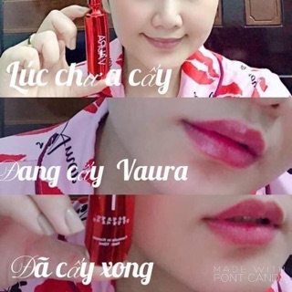 Cấy môi baby lips volume
