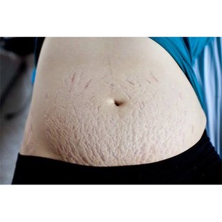 Công dụng mỡ trăn