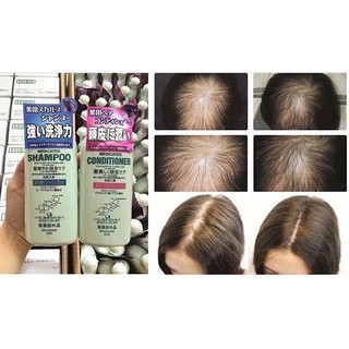 Cặp đầu gội chống dụng tóc vs kích thích mọc tóc của nhật