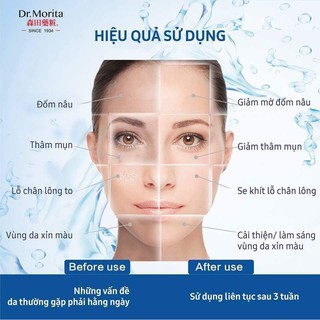 Dr Morita - Lẻ 1 Miếng Mặt Nạ Tràm Trà & Cam Thảo