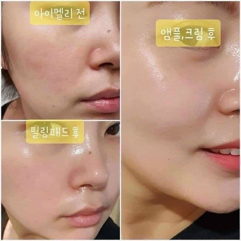 Dưỡng collagen