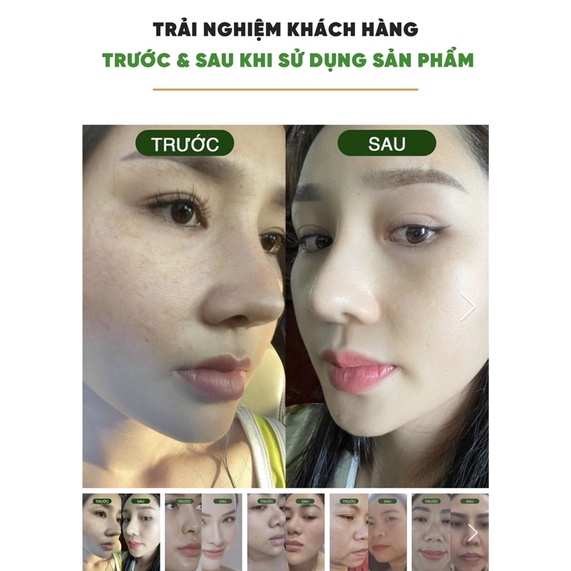 SIÊU VI TẢO GREEN VITA RECOVERY SỨC MẠNH CHỐNG LÃO HÓA ĐẾN TỪ "BÍ THUẬT" NHẬT BẢN | BigBuy360 - bigbuy360.vn