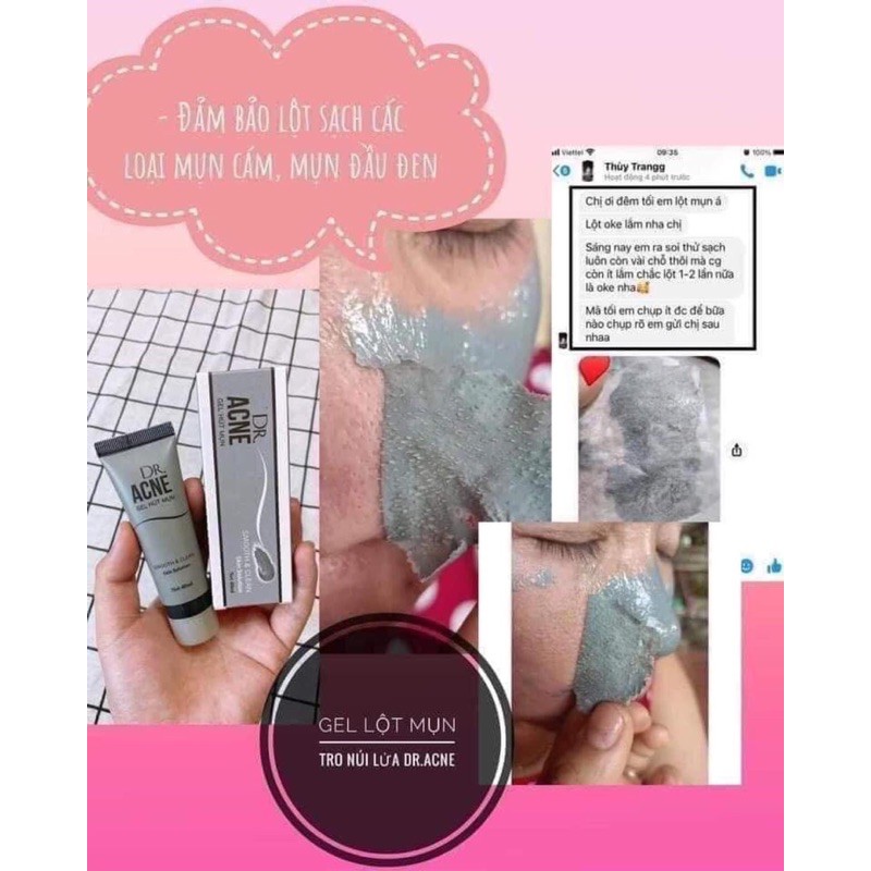 Gel lột mụn dr acne