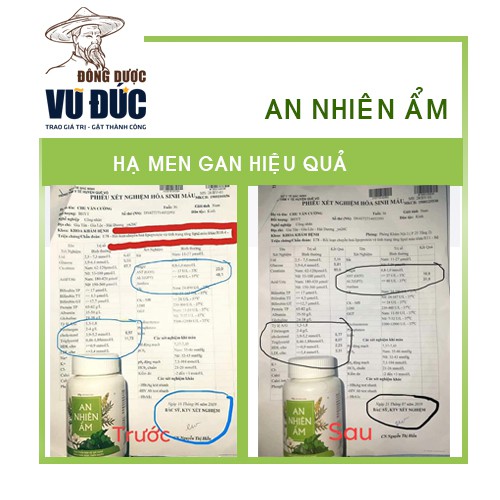 AN NHIÊN ẨM: Giảm Gan Nhiễn Mỡ, Máu Nhiễm Mỡ, Men Gan Cao, Guot, Thải Độc, Đông Dược Vũ Đức. | BigBuy360 - bigbuy360.vn
