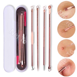 Bộ 4 cây nặn mụn chuyên dụng