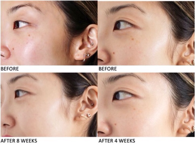 K.IEHL'S SERUM DƯỠNG TRẮNG K.IEHL CLEARLY CORRECTIVE DARK SPOT SOLUTION