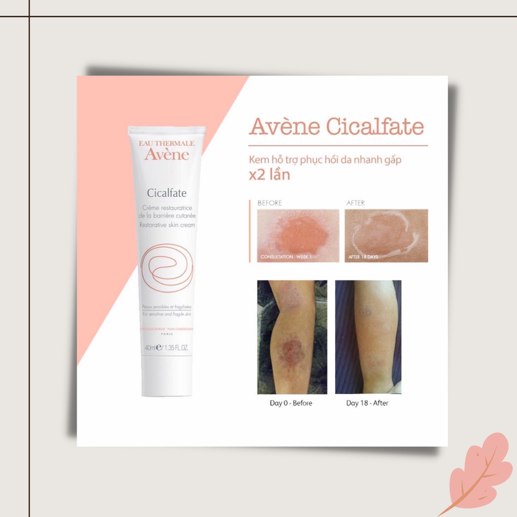 Kem Dưỡng Phục Hồi, Liền Sẹo Avene Cicalfate Cream