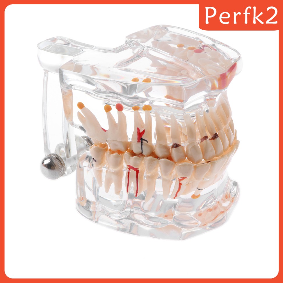 2x Human Mouth Dental Teeth Pathological Model Teaching Study Tools Clear