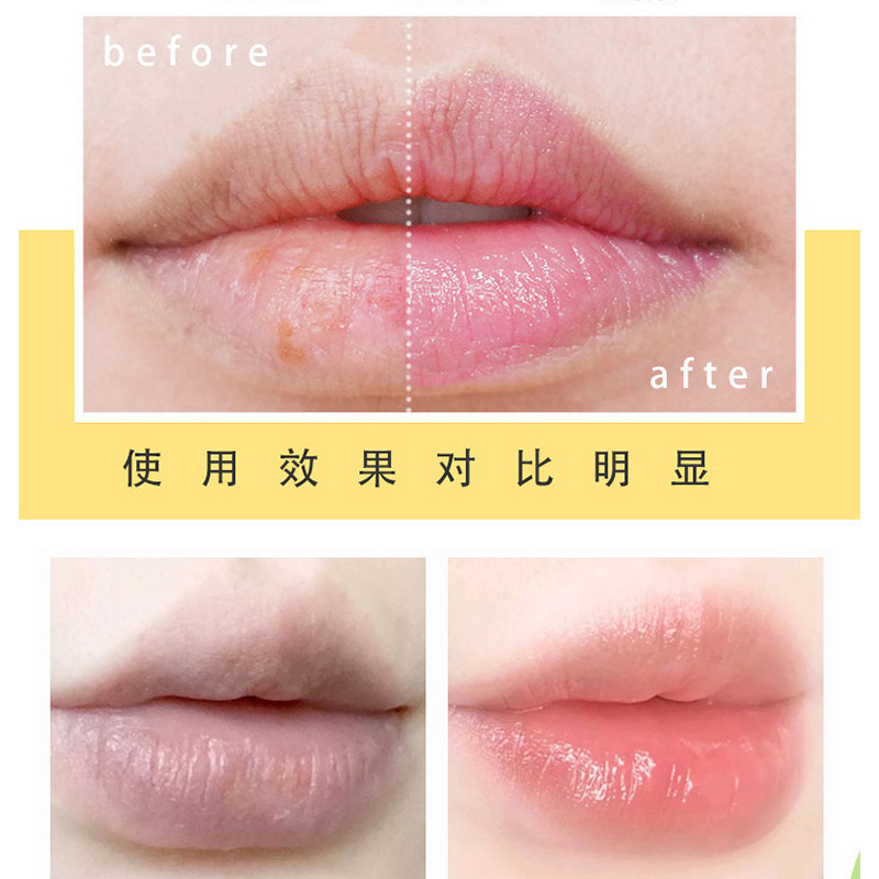 (Hàng Mới Về) Son Dưỡng Môi Chiết Xuất Bơ Hạt Mỡ Dưỡng Ẩm Chống Khô Môi | BigBuy360 - bigbuy360.vn