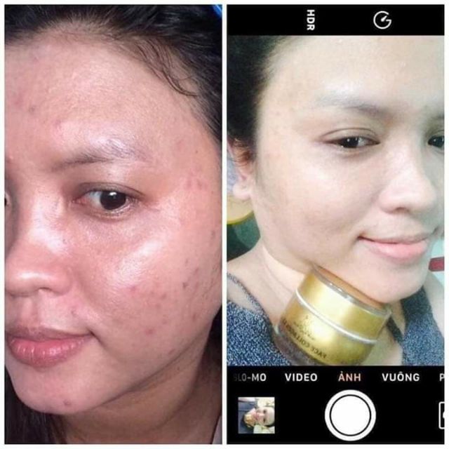 Kem face colagen X3 chính hãng có team check mã | BigBuy360 - bigbuy360.vn