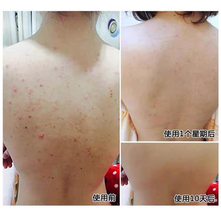 [HOT] ✨XÀ PHÒNG MUỐI BIỂN SỮA DÊ PROTEIN✨