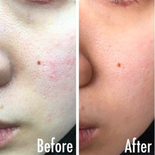 [Mèo Ú- Bill] CNP Invisible peeling booster