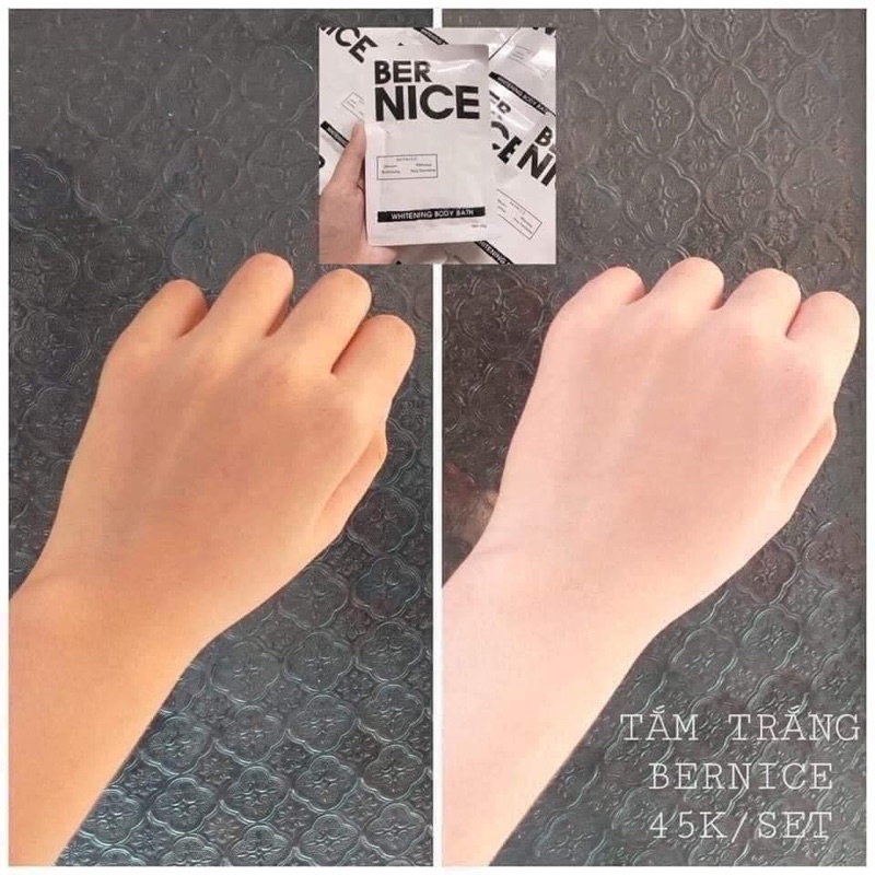 COMBO 3 GÓI TẮM TRẮNG BERNICE | BigBuy360 - bigbuy360.vn