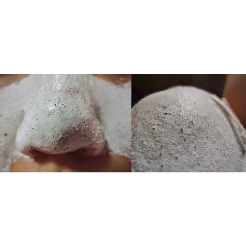 GEL PEELING PACK LỌ 25g LỘT MỤN ĐẦU ĐEN MỤN CAMSGIAS TỐT