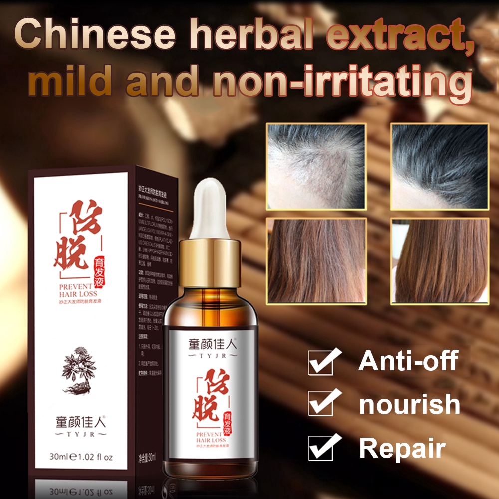 [Hàng mới về] Thuốc dưỡng tóc chống rụng tóc dung tích 30ml