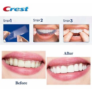 MIẾNG DÁN TRẮNG RĂNG CREST 3D WHITE Professional EffectS