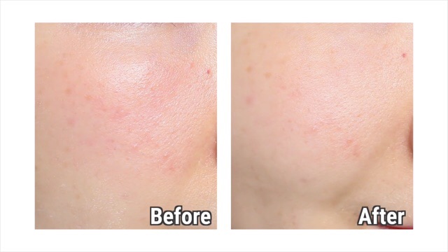  Kem Dưỡng Da Phục Hồi Klairs Midnight Blue Calming Cream | BigBuy360 - bigbuy360.vn