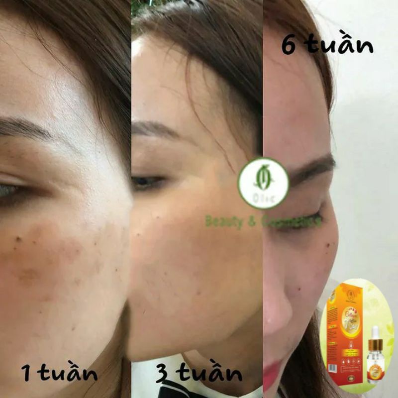 [Chính Hãng] SERUM COLLAGEN SAFFRON TÁI SINH 7 DAY OLIC (huyết thanh truyền trắng olic mẫu mới) | BigBuy360 - bigbuy360.vn