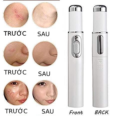 🌟Bút ánh sáng xanh trị liệu 💢 Loại bỏ các vết mụn, chữa mụn, giảm mụn💢Làm căng da, thu nhỏ lỗ chân lông🌟♥️ | BigBuy360 - bigbuy360.vn