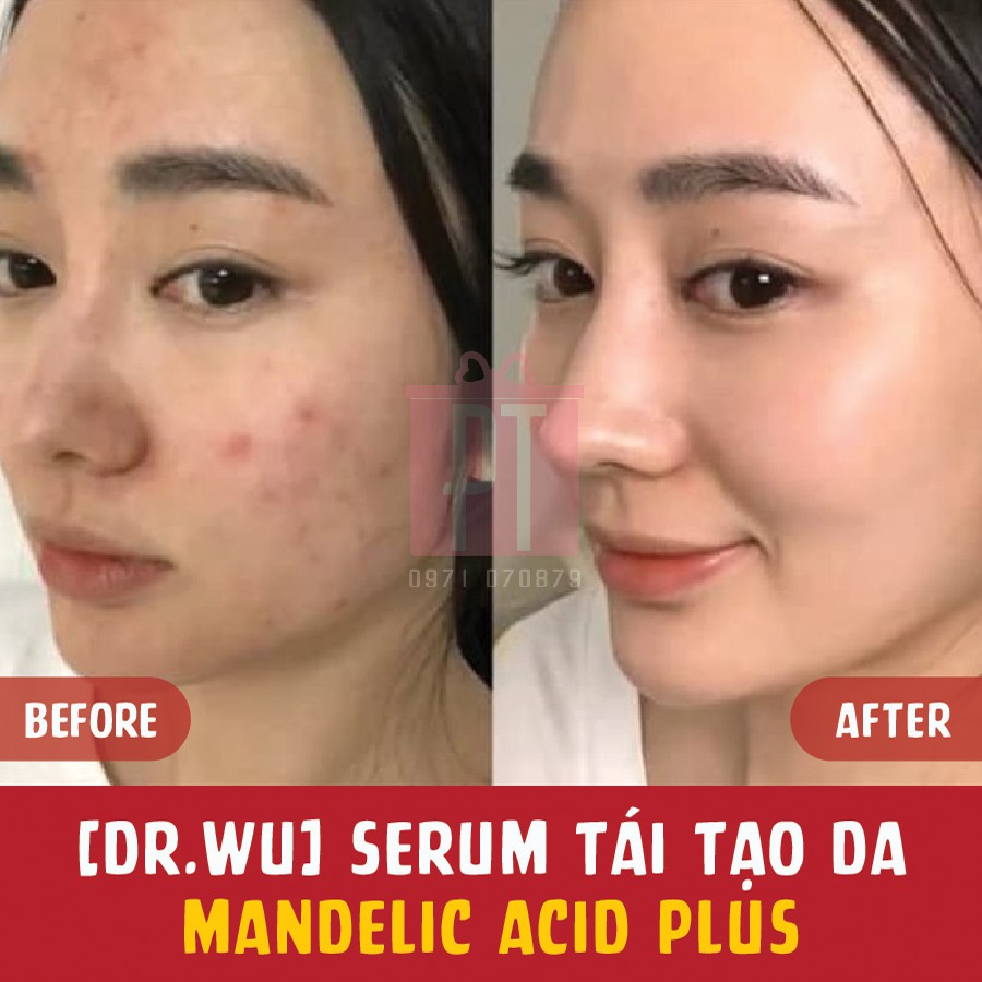 (Không vỏ) Serum Plus Tái Tạo Da Dr.wu Đài Loan 5ml | BigBuy360 - bigbuy360.vn