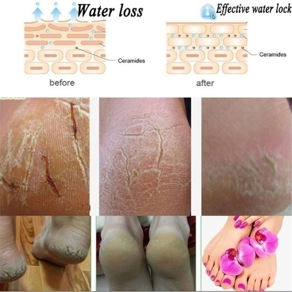 Set 2 chiếc vớ silicon bảo vệ gót chân